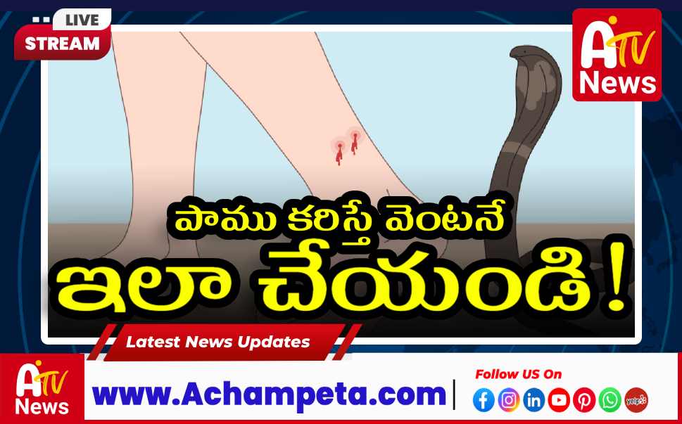 పాము కాటుకు ప్రథమ చికిత్స - ప్రాణాలను రక్షించే మార్గాలు